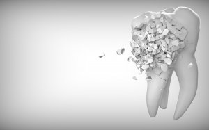 Разрушение зуба  - скачать обои на рабочий стол